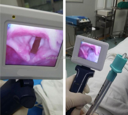 Portable video laryngoscope with 3pcs reusable blade