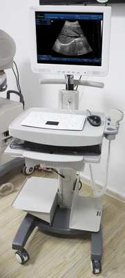 Touch screen 3D Ultrasound Scanner Machine-- SS-100
