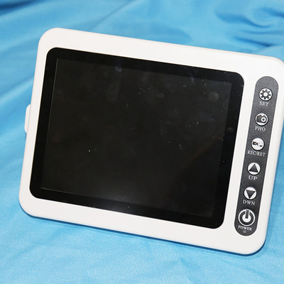 8 Inch Monitor ENT Surgical Instruments Medical Ent Endoscope Video Laryngoscope Camera