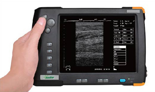 Palm Ultrasound ScannerSU-V5(ultrasonic,black white,Imaging System)