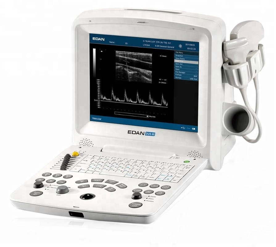 DUS 60 new compact ultrasound system